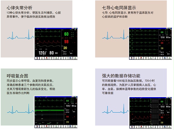 多参数监护仪M-8000E-产品细节展示