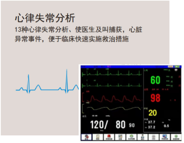 多参数监护仪M-8000E-产品细节展示1