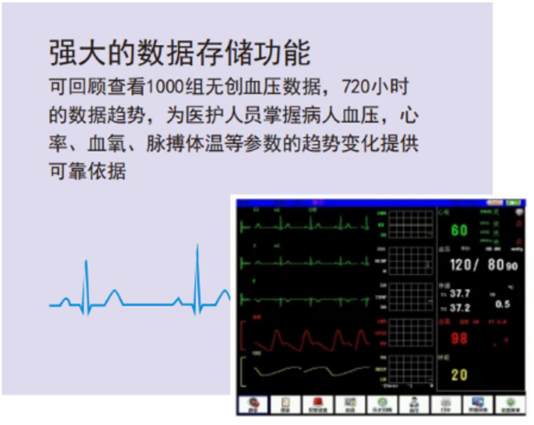 多参数监护仪M-8000E-产品细节展示4