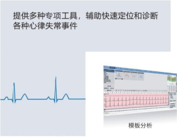 动态心电记录仪E12-产品细节展示2