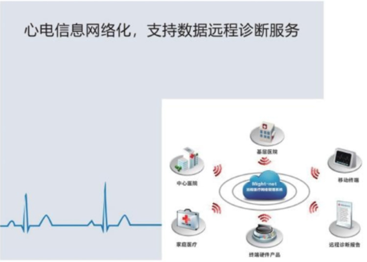 动态心电记录仪E12-产品细节展示4