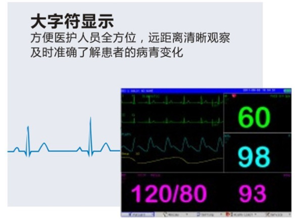 多参数监护仪M-9000E-产品细节展示1