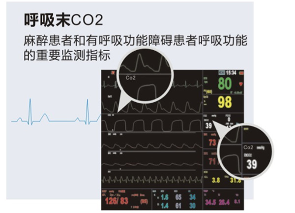 多参数监护仪M-9000E-产品细节展示2