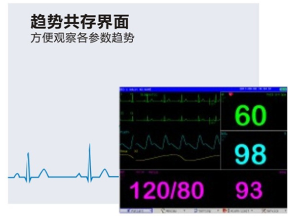 多参数监护仪M-9000E-产品细节展示3